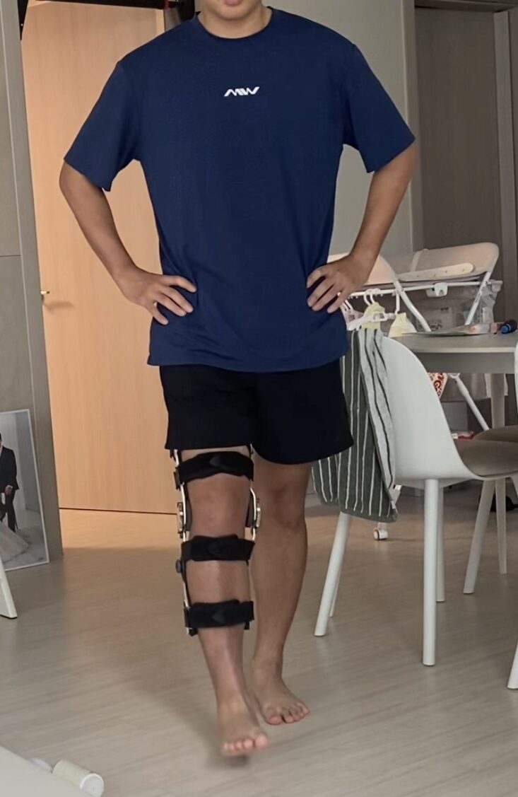 후방십자인대 재활