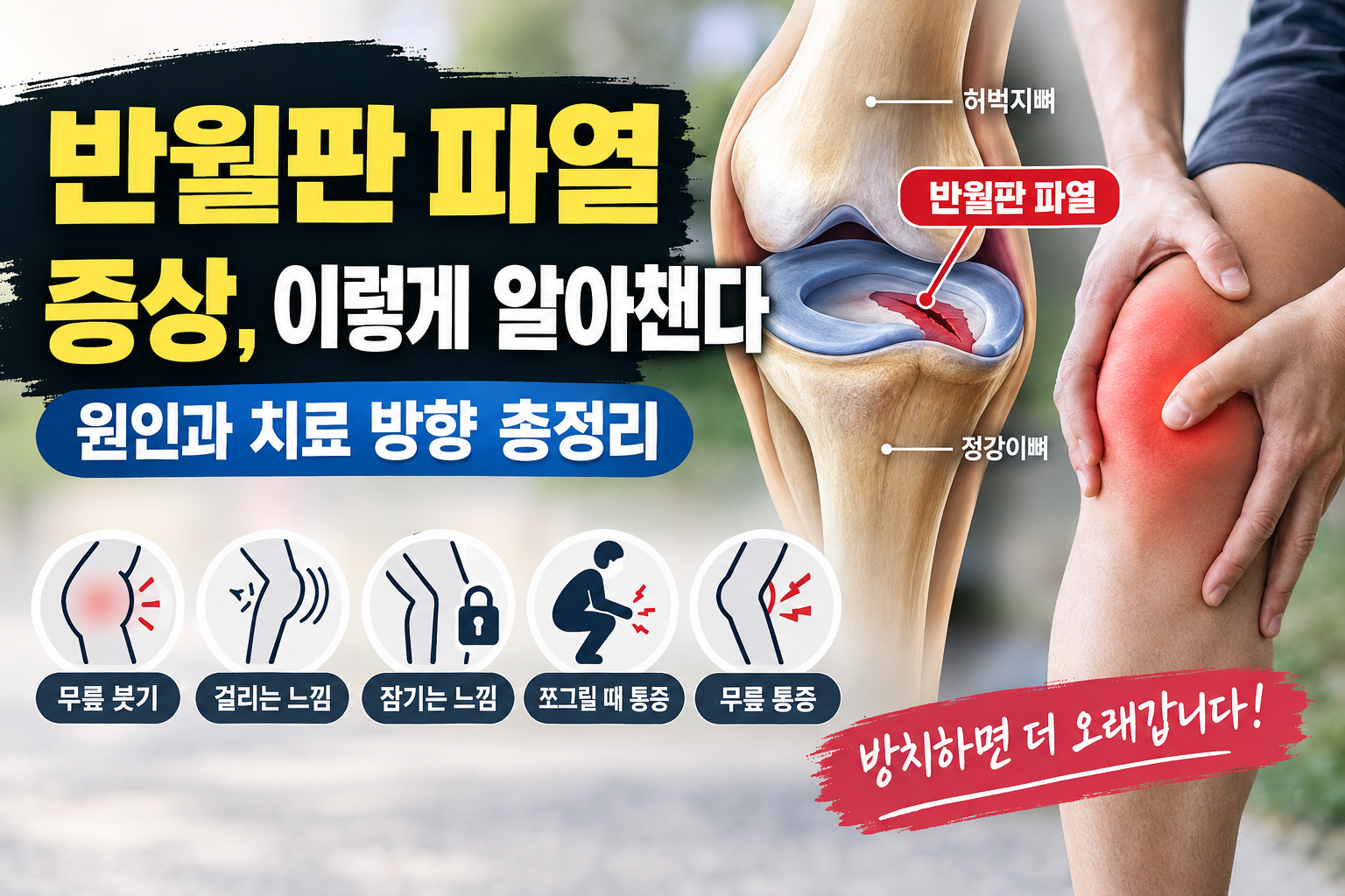 반월판 파열 증상, 이렇게 알아챈다 | 원인과 치료 방향 총정리