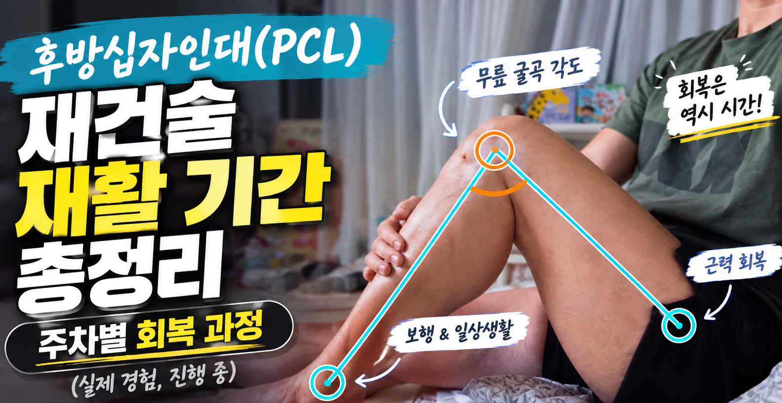 후방십자인대 재건술 재활 기간(PCL 재건술 재활) 총정리 | 주차별 회복 과정 (실제 경험, 진행 중)