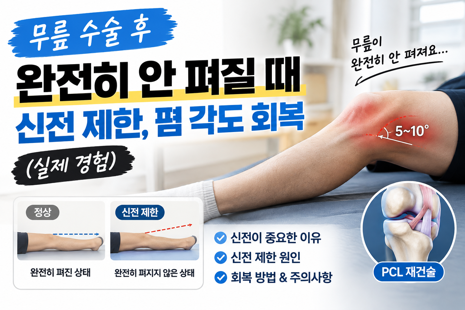 무릎 신전 제한 | 무릎 수술 후 완전히 안 펴질 때 , 폄 각도 회복 (실제 경험)