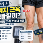 무릎 수술 후 근육