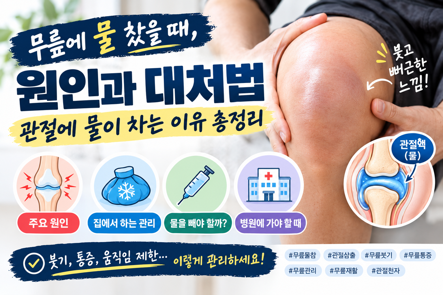 무릎에 물 찼을 때, 원인과 대처법 | 관절에 물이 차는 이유 총정리