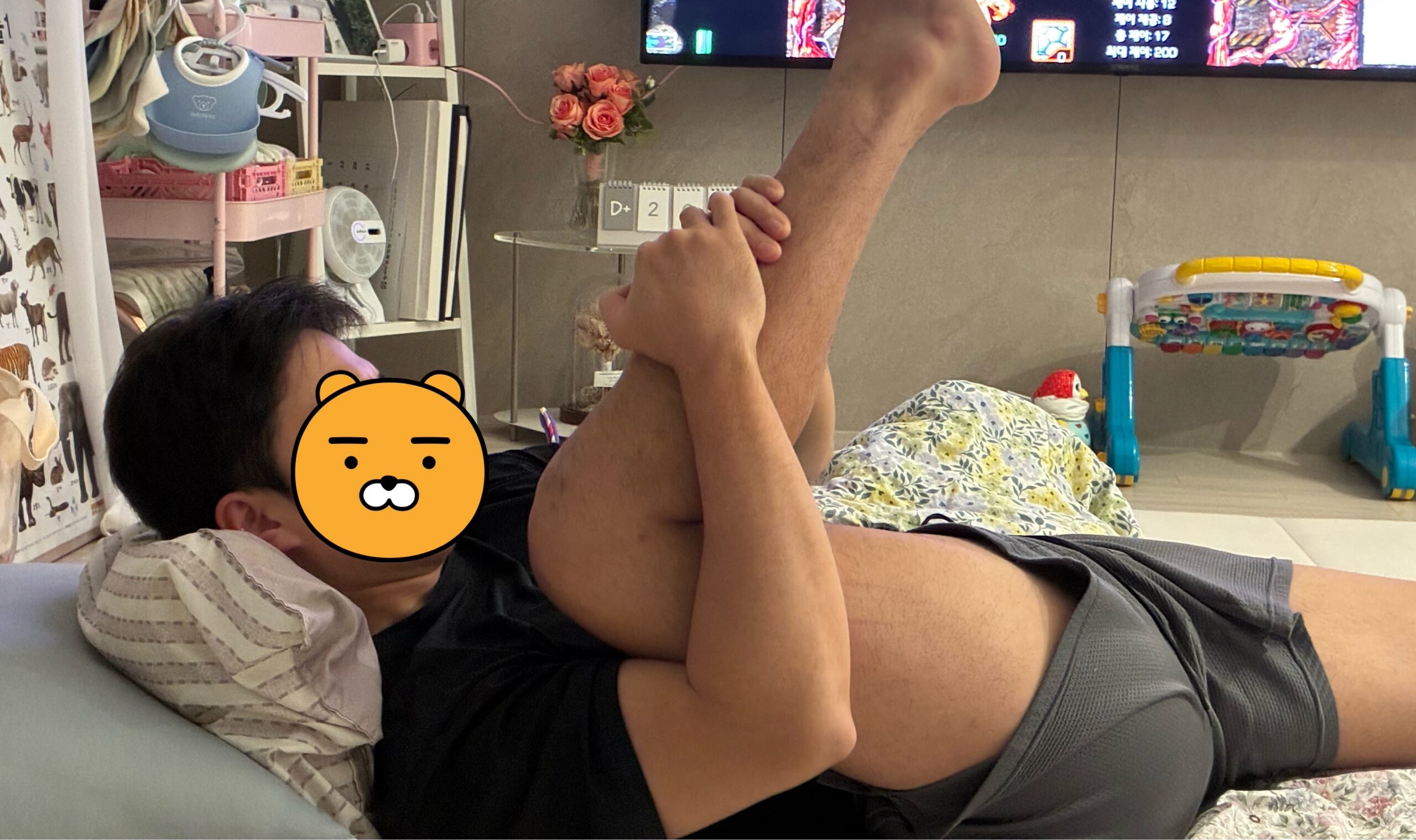 후방십자인대 재건술