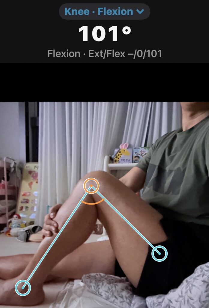 후방십자인대 재건술
